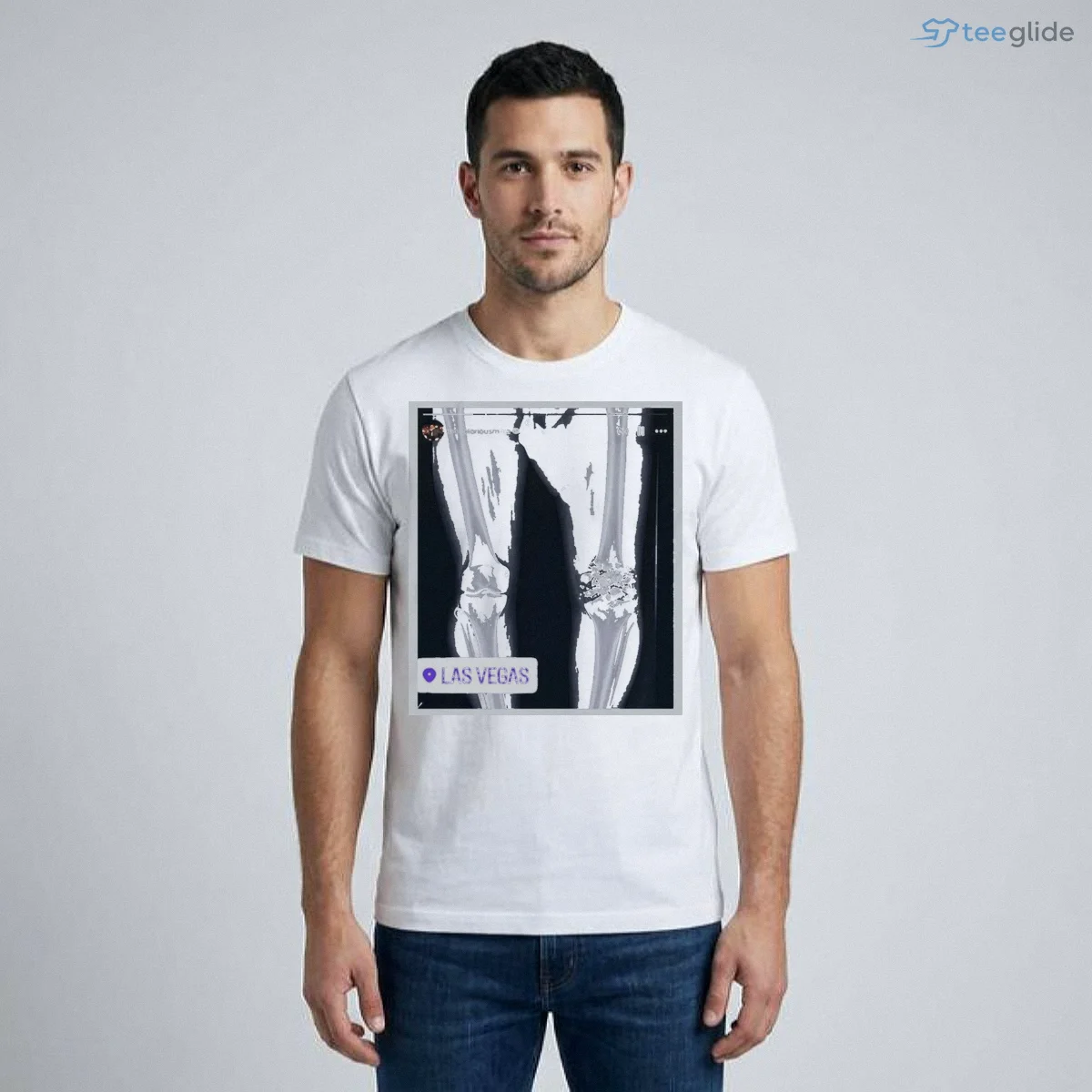 funny conor mcgregor x ray broken knee knee shirt 1 funny conor mcgregor x ray broken knee knee shirt 1