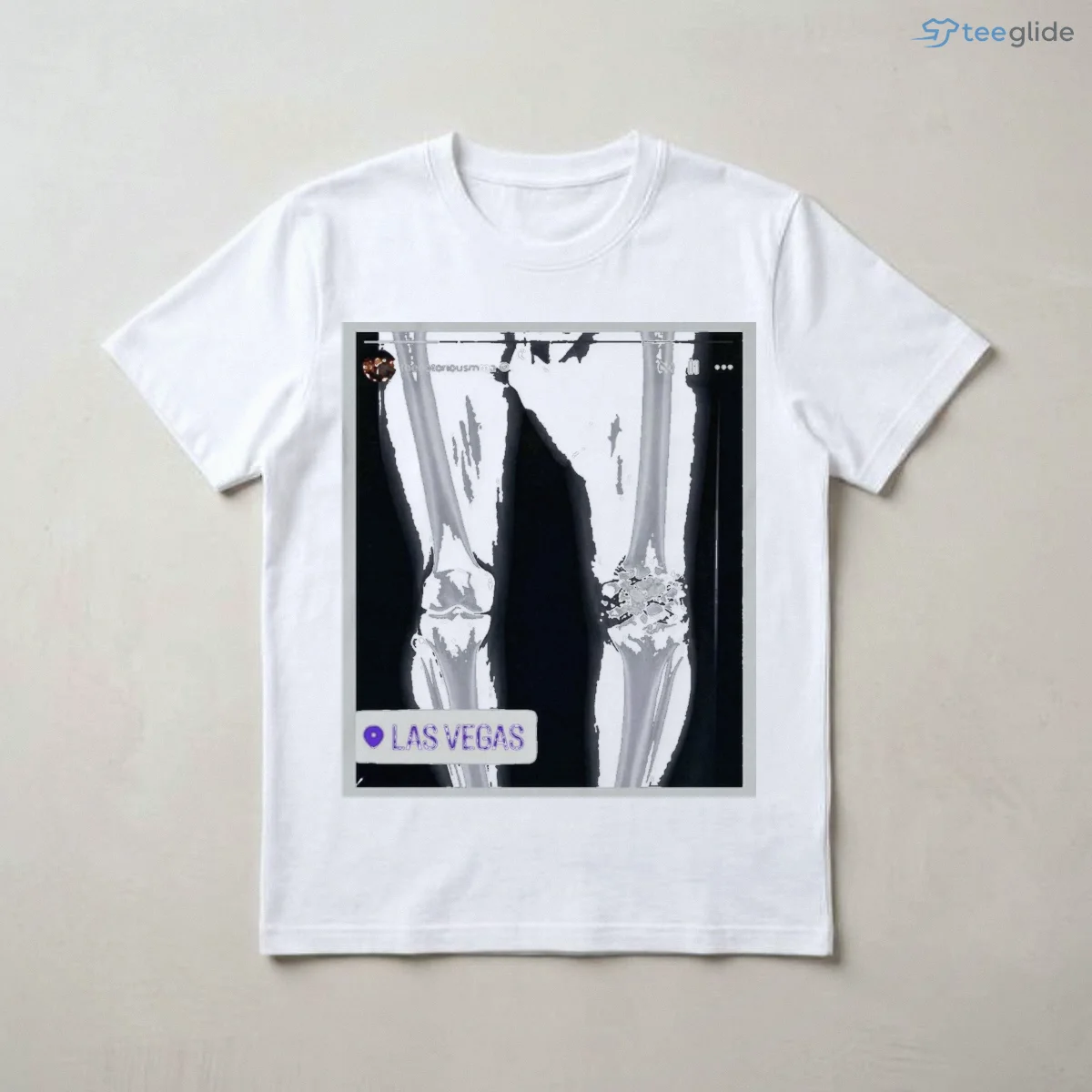 funny conor mcgregor x ray broken knee knee shirt 3 funny conor mcgregor x ray broken knee knee shirt 3
