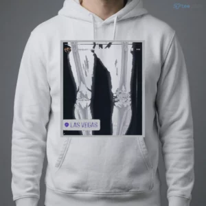 Funny Conor McGregor X-Ray Broken Knee Knee Shirt 3 funny conor mcgregor x ray broken knee knee shirt 4