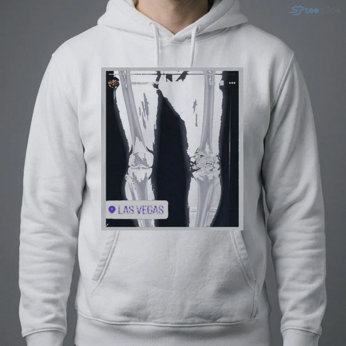funny conor mcgregor x ray broken knee knee shirt 4 funny conor mcgregor x ray broken knee knee shirt 4